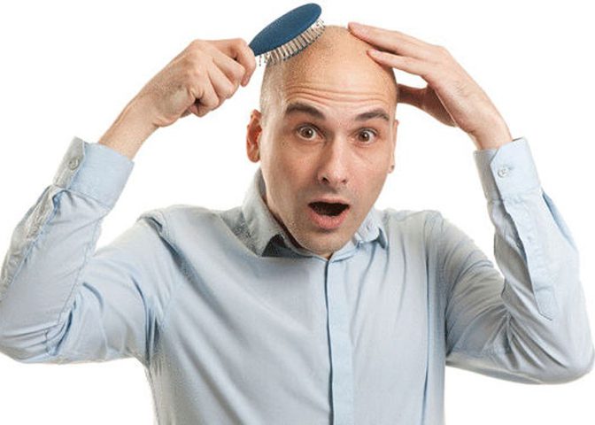 كيف يؤثر الصلع على الصحة النفسية للرجل؟