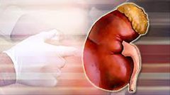 الهولميوم ليزر.. علاج آمن لحصوات الكلى‬