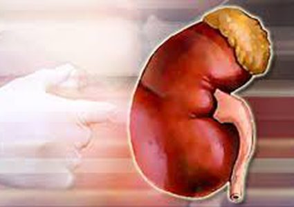 الهولميوم ليزر.. علاج آمن لحصوات الكلى‬