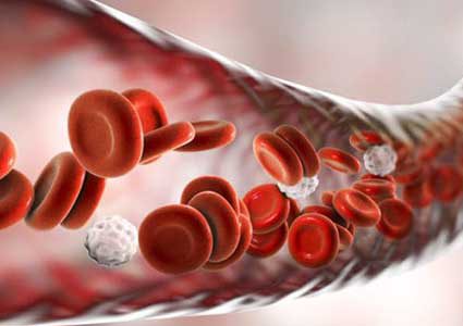 ما هو تسمم الدم والأشخاص المحتمل إصابتهم به ؟