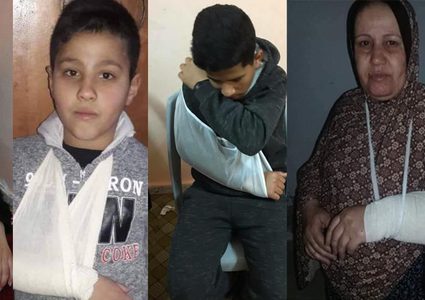 الصحفية البحيصي تنشر صورا لأفراد عائلتها تعرضوا للضرب من أمن حماس