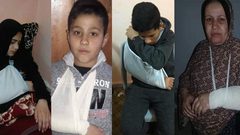 الصحفية البحيصي تنشر صورا لأفراد عائلتها تعرضوا للضرب من أمن حماس
