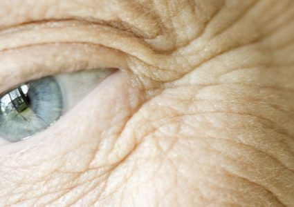 دراسة: تجاعيد البشرة قد تقلل من خطر الاصابة بعدة أمراض مزمنة