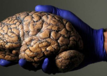 بتقنية 5G.. أول جراحة دماغية في العالم عن بعد 3 آلاف كم!