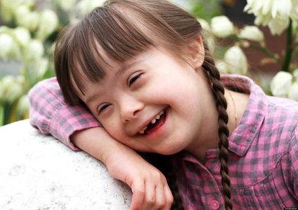 في غزة: متلازمة داون يحبهم ذويهم وتقتلهم نظرة المجتمع