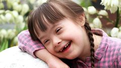 في غزة: متلازمة داون يحبهم ذويهم وتقتلهم نظرة المجتمع