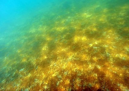 بشرى سارة..علماء يستخدمون الطحالب لمنع بتر الأطراف