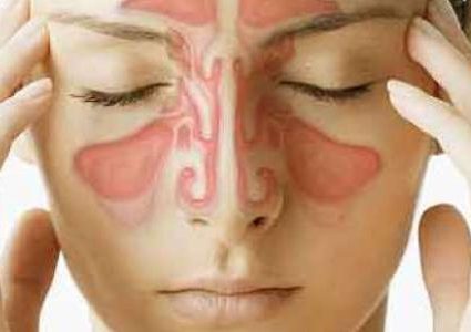 دراسة: مرضى حساسية الجيوب الانفية اقل عرضة للاصابة بالسرطان