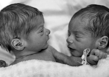 في حالة نادرة.. امرأة تلد توأمين من رجلين مختلفين