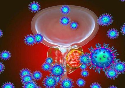 أورام البروستاتا تنتشر بواسطة "بصق" بروتين يوقظ الخلايا السرطانية