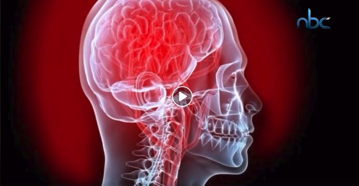 علاقة أمراض القلب بالمخ وهل تؤدي الى الخرف؟
