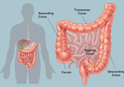 أسباب التهاب القولون أهمها الوراثة والأطعمة الدسمة