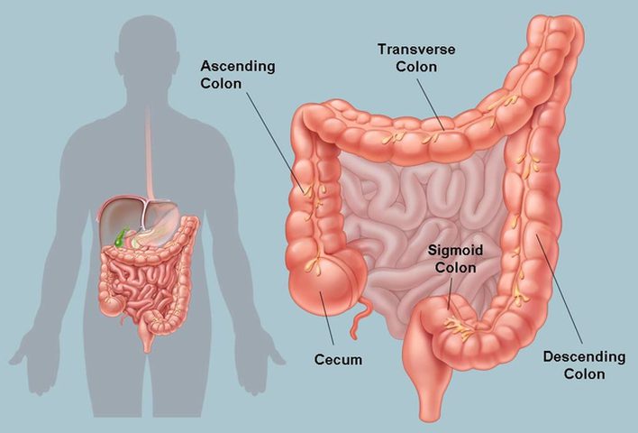 أسباب التهاب القولون أهمها الوراثة والأطعمة الدسمة