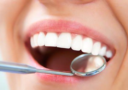 معلومات صادمة عن "تبييض الأسنان"
