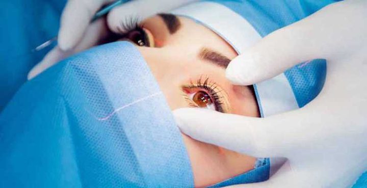 طبيب: خطوات للمحافظة على العين بعد عملية الليزك لضمان نجاحها..