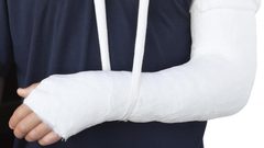 نصائح مهمة للتعامل مع كسور العظام