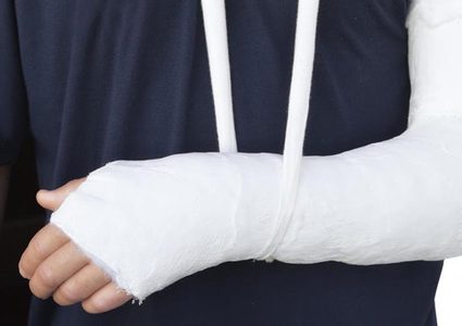 نصائح مهمة للتعامل مع كسور العظام