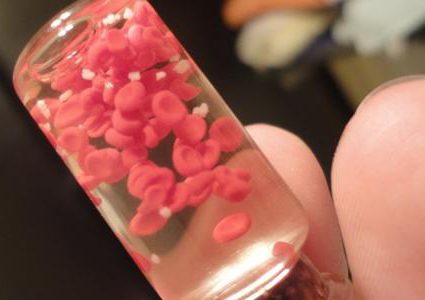 الطريقة الطبيعية لزيادة عدد الصفائح الدموية في الجسم