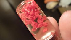 الطريقة الطبيعية لزيادة عدد الصفائح الدموية في الجسم