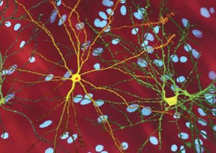 اكتشاف وسيلة مضادة لأمراض الدماغ المميتة