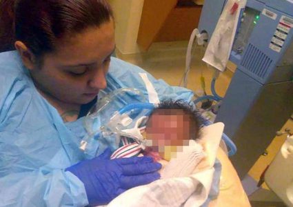 ولادة نادرة تحير الأطباء في أميركا