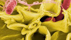 دراسة: ميكروبات الأمعاء تمنع الإصابة بمرض السالمونيلا