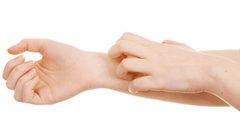 5 أشياء تحفز ظهور الأكزيما على الجلد