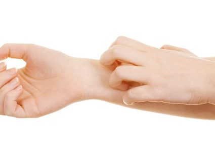 5 أشياء تحفز ظهور الأكزيما على الجلد