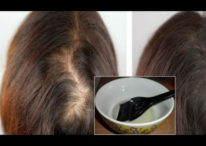 4 وصفات لعلاج فراغات الشعر بسهولة .. خلطة الزيوت