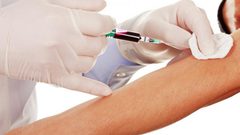 لماذا يفقد بعض الأشخاص الوعي عند رؤية الدم ؟