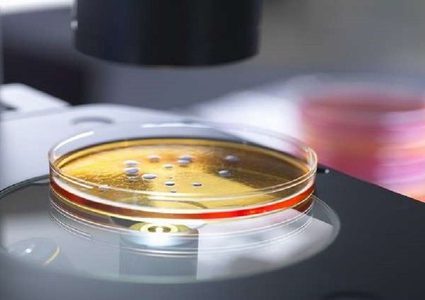 البكتيريا قد تصبح أكثر فتكا بالبشر من السرطان