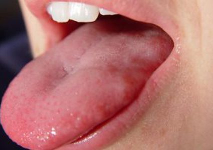 دراسة: الأنف واللسان يمتلكان نفس المستقبلات للطعم والرائحة