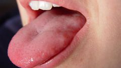 دراسة: الأنف واللسان يمتلكان نفس المستقبلات للطعم والرائحة