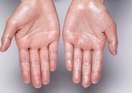 حالة شائعة "تدمر" حياة الناس!