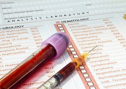 أسباب شيوع فصيلة الدم O