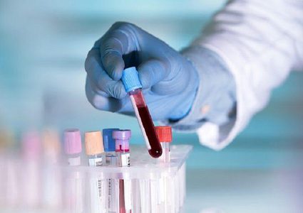 تطوير اختبار دم يمكنه تتبع مرض الزهايمر