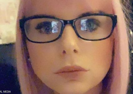 صورة "مخيفة" لفتاة بعد عملية تجميل