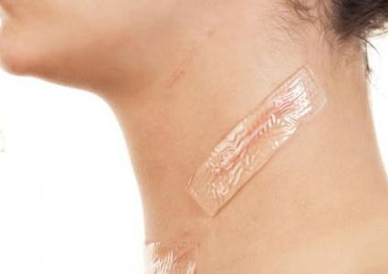 كيف تتخلص من الندبات الجلدية وآثار الجروح؟