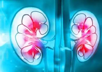 دراسة: سرطان الكلى يهدد الأطفال البدناء طوال القامة