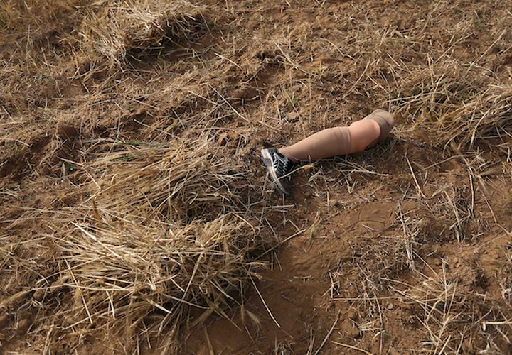 صهيب قديح 33 عامًا ، وأخته نزيهة قديح 38 عامًا ، فقدا ساقيهما بعد إطلاق النار عليهما من قبل قوات الاحتلال الإسرائيلي خلال  مسيرات العودة الأسبوعية، في حصاد محصول القمح في حقلهما ، في خان يونس جنوب قطاع غزة .