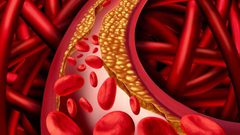 خلطة خارقة للتخلص من ارتفاع الضغط وانسداد الشرايين والكوليسترول