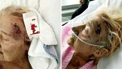 اعتداء وحشي يقتل مريضة عجوز بمستشفى بسبب "الشخير"!