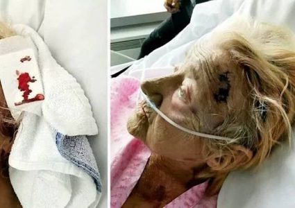 اعتداء وحشي يقتل مريضة عجوز بمستشفى بسبب "الشخير"!