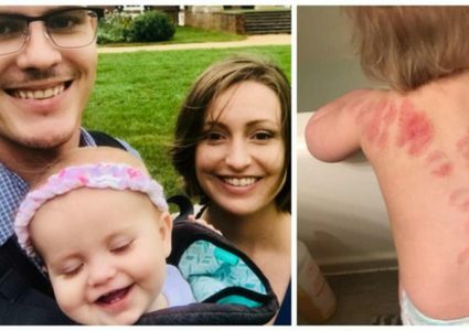 طفلة تتعرّض لأكثر من 25 عضّة في الحضانة!