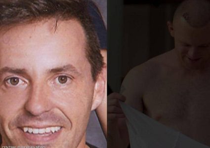 وفاة رجل خلال عملية زراعة شعر.. وخبراء يكشفون السبب