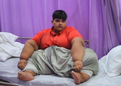 بعد محاولات بائسة.. طبيب يتعهد بعلاج الطفل الأكثر بدانة في العالم