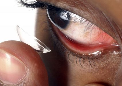 لم تنزع العدسات اللاصقة ليلا ففقدت بصرها