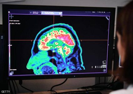 دراسة تكشف "الوصفة السحرية" لتجنب الخرف