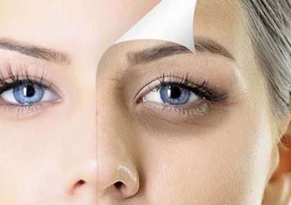 طرق القضاء على الهالات السوداء بسبب السهر في رمضان