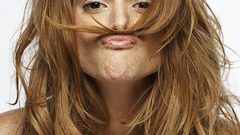 تعرف على أسباب زيادة شعر الجسم والوجه عند السيدات..؟!